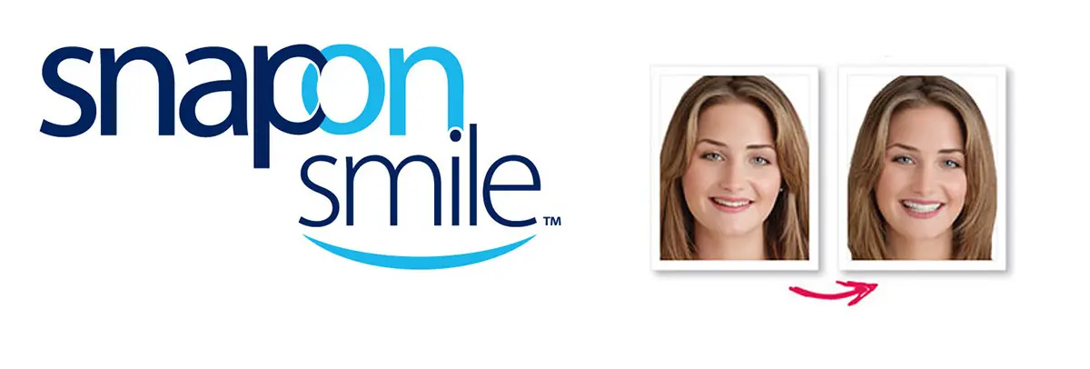 snap-on-smile-logo-banner.webp